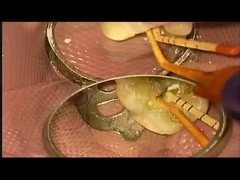 SANI TREATMENT DAVAR